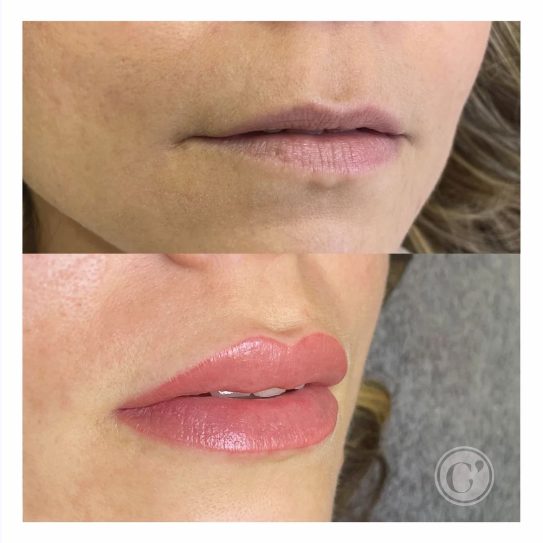 micropigmentacio efecte gloss